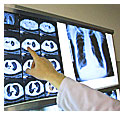 Radiografia